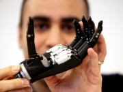 Bιονικό χέρι με τεχνητή νοημοσύνη