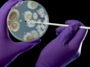 ΠΟΥ: Ο ιός Ζίκα θα &quot;κατακτήσει&quot; την αμερινακινή ήπειρο