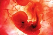 Συμπόσιο γυναικολόγων: Παθολογία του εμβρύου