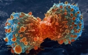 Ελλάδα: 37.000 νέα κρούσματα καρκίνου κάθε χρόνο