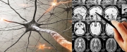 Νεότερες εξελίξεις στη Νευρολογία